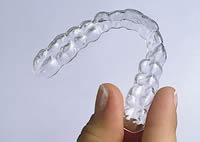 Invisalign