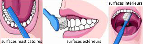 Technique de brossage des dents MEI
