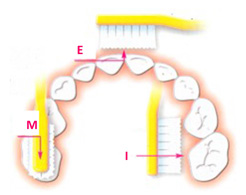 Technique de brossage des dents MEI