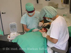 Laserbehandlung Zahnarzt