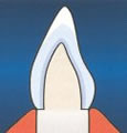 all-porcelain crowns