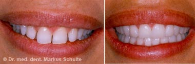 Asthetische Zahnmedizin Schone Zahne Zahnarzt Team Luzern